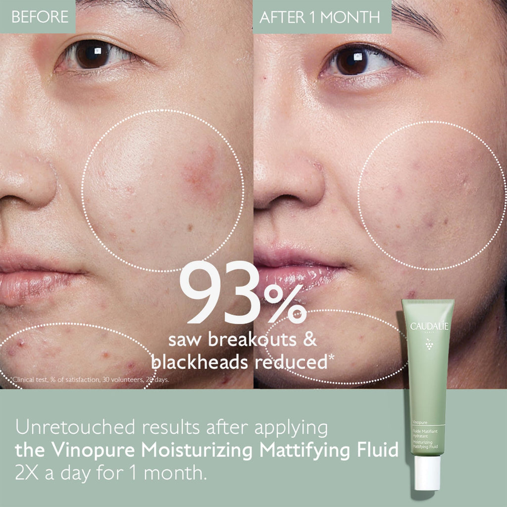 Oil Control Moisturizer 40 mL C637067